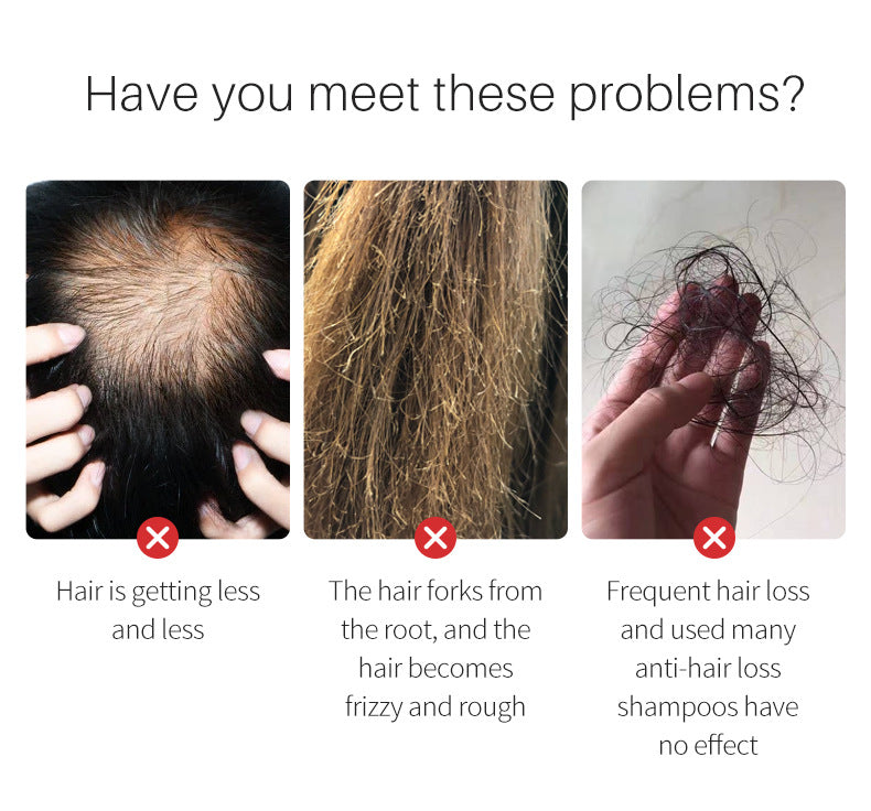 Scalp showing hair thinning with hands parting hair, highlighting hair loss issues for all hair types.